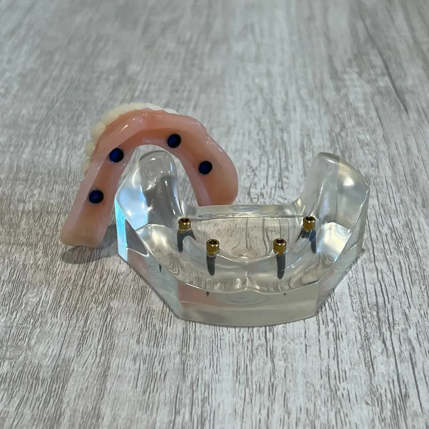 snap-in implant dentures Duluth, GA